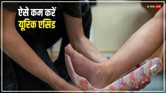 इन वजहों से बढ़ता है यूरिक एसिड, इन नेचुरल फूड को खाने से मिलेगा आराम