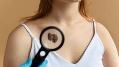 Skin Cancer: शरीर पर दिखने वाले ये मामूली बदलाव हो सकते हैं स्किन कैंसर के लक्षण