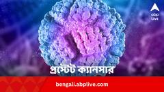 প্রস্টেট ক্যানসারের চেনার নয়া ধরন ‘বলে দিল’ AI, আমূল বদল আসবে চিকিৎসায় ?