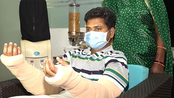 Hand Transplantation : చేతులు పోయిన వ్యక్తికి రెండు కొత్త చేతులిచ్చిన డాక్టర్లు | ABP Desam