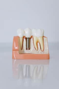 National Dentist's Day :या  जीवनसत्त्वांच्या कमतरतेसोबतच हा निष्काळजीपणा देखील तुम्हाला पायरियाचा शिकार बनवू शकतो !