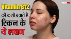 अगर स्किन पर हो रहे हैं ये बदलाव तो वो थकान से नहीं, इस विटामिन की कमी से है! ऐसे करें ठीक