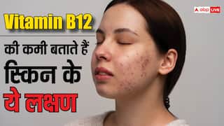 अगर स्किन पर हो रहे हैं ये बदलाव तो वो थकान से नहीं, इस विटामिन की कमी से है! ऐसे करें ठीक