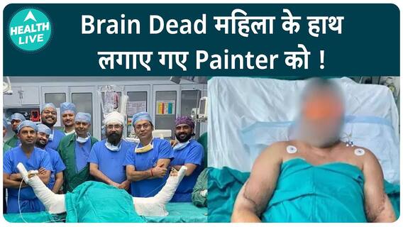 दिल्ली के पेंटर को हाथ वापस मिले ,अंग दान और डॉक्टर्स की मदद से | Health Live