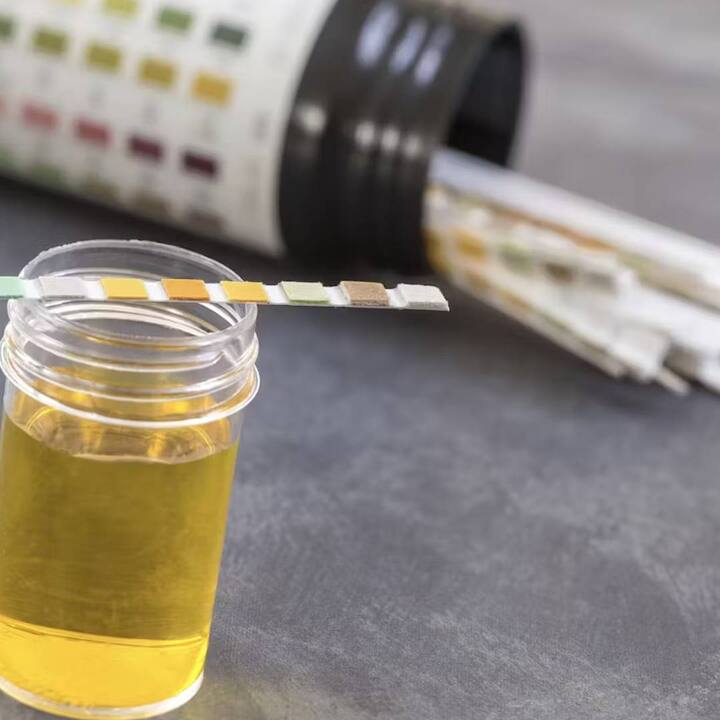 ਵਿਟਾਮਿਨ ਬੀ ਦੇ ਕਾਰਨ ਤੁਹਾਡੇ ਪਿਸ਼ਾਬ ਦਾ ਰੰਗ ਚਮਕਦਾਰ ਪੀਲਾ ਹੋ ਸਕਦਾ ਹੈ, ਇਸਦਾ ਸਰੀਰ ਦੀ ਸਿਹਤ 'ਤੇ ਕੋਈ ਬੁਰਾ ਪ੍ਰਭਾਵ ਨਹੀਂ ਪੈਂਦਾ, ਇਸ ਲਈ ਘਬਰਾਉਣ ਦੀ ਜ਼ਰੂਰਤ ਨਹੀਂ ਹੈ। ਇਹ ਸਾਬਤ ਕਰਦਾ ਹੈ ਕਿ ਤੁਹਾਡੀ ਖੁਰਾਕ ਪੂਰਕ ਪਿਸ਼ਾਬ ਦਾ ਰੰਗ ਕਿਵੇਂ ਨਿਰਧਾਰਤ ਕਰ ਸਕਦੇ ਹਨ।