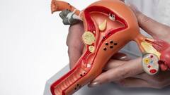 Cervical Cancer: क्यों होता है सर्वाइकल कैंसर? किन महिलाओं को होने की संभावना होती है ज्यादा