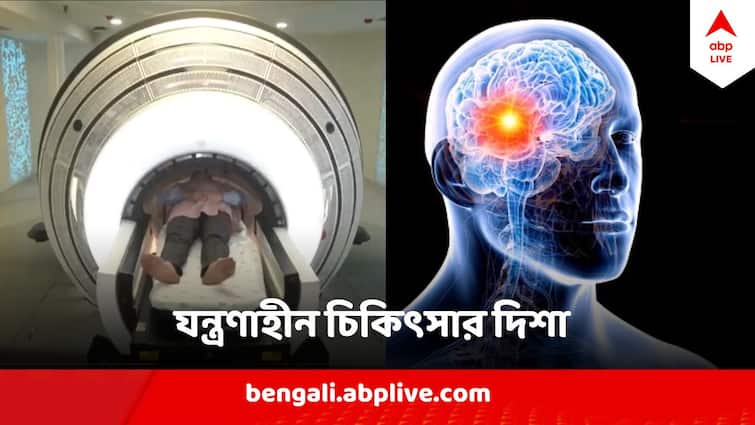 Brain Tumor Treatment With ZAP-X in Delhi First In India South Asia Health News In Bangla Brain Tumour Treatment: ছুরি-কাঁচি ছাড়া ব্রেন টিউমরের চিকিৎসা, তাও ৩০ মিনিটের সেশন ! ভারতে এল ZAP-X প্রযুক্তি