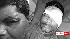 పులివెందులలో దస్తగిరి తండ్రిపై దాడి - వైసీపీ వర్గీయుల పనేనని అనుమానం