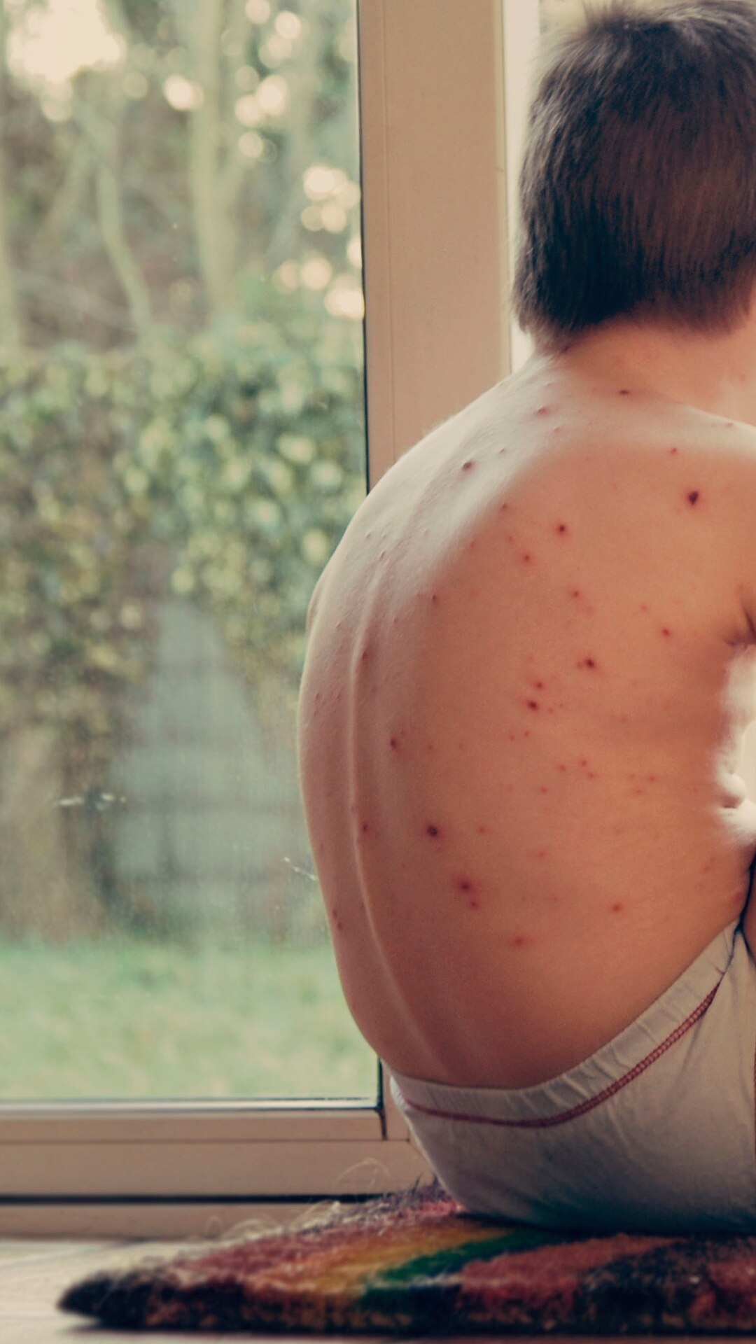 Some rashes such as those caused by viral infections like