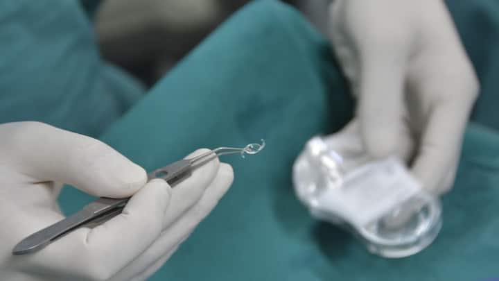 ভারতেই প্রথম চোখের ছানির অস্ত্রোপচার হয়। প্রাচীন ভারতে ছানির অস্ত্রোপচার প্রচলিত ছিল। বাঁকানো সূচের মাধ্যমে ছানি বের করে আনা হতো। তার পর গরম ঘি মাখিয়ে ব্যান্ডেজ বেঁধে দেওয়া হতো চোখে। একান্ত প্রয়োজন না হলে যদিও এই পদ্ধতিতে ছানি কাটা উচিত নয় বলে সতর্কবার্তা দিয়েছিলেন সুশ্রুত। ছবি: পিক্সাবে।