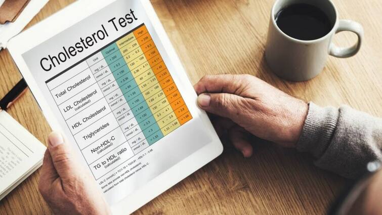 High Cholesterol Causes Symptoms and How It Affects the Body High Cholesterol: खराब कोलेस्ट्रॉल बढ़ने पर शरीर में दिखने लगते हैं ये लक्षण, जानें इसका नॉर्मल लेवल क्या है?