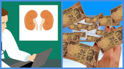 Bangalore CA sell kidney for money due to debt gets scammed out of Rs 6.2 lakh Kidney Scam: கடனை அடைக்க சிறுநீரகத்தை விற்க சென்ற ஆடிட்டரிடம் ரூ.6.2 லட்சம் மோசடி...என்ன நடந்தது?