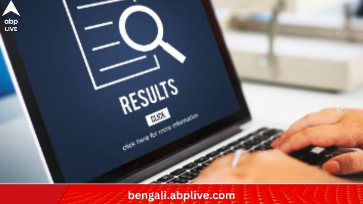 ছন্দ মিলিয়ে কোনও জিনিস মনে রাখার কৌশলও দারুণ কাজে দিতে পারে। ছোটবেলায় যে ছড়া মুখস্থ করতেন, বড় হয়েও কঠিন কিছু মনে রাখার ক্ষেত্রে একই ভাবে নিজের মতো করে ছড়া বানিয়ে নিতে পারেন। শুধু অন্ত্যমিল থাকলেই হবে। এতে মনে রাখতে সুবিধা হয়।