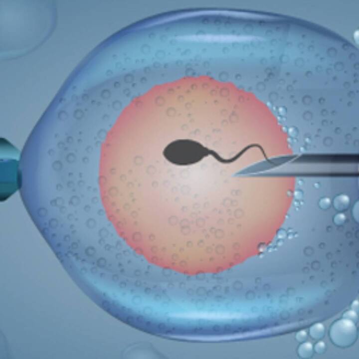 ਇਲਾਜ ਦੇ ਸਾਰੇ ਵਿਕਲਪਾਂ ਬਾਰੇ ਜਾਣਨ ਅਤੇ ਤੁਹਾਡੇ ਲਈ ਇਲਾਜ ਦਾ ਸਹੀ ਤਰੀਕਾ ਚੁਣਨ ਲਈ ਡਾਕਟਰ ਦੀ ਸਲਾਹ ਜ਼ਰੂਰੀ ਹੈ। ਮਾਂ ਬਣਨ ਦੀਆਂ ਚਾਹਵਾਨ ਔਰਤਾਂ ਨੂੰ ਸਮਾਜਿਕ ਦਬਾਅ ਜਾਂ ਗੱਲ-ਬਾਤ ਦੀ ਪਰਵਾਹ ਕੀਤੇ ਬਿਨਾਂ ਡਾਕਟਰ ਦੀ ਸਲਾਹ ਲੈਣੀ ਚਾਹੀਦੀ ਹੈ।