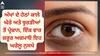 Skin Care Tips: ਅੱਖਾਂ ਦੇ ਹੇਠਾਂ ਕਾਲੇ ਘੇਰੇ ਅਤੇ ਝੁਰੜੀਆਂ ਤੋਂ ਪ੍ਰੇਸ਼ਾਨ, ਇੱਕ ਵਾਰ ਜ਼ਰੂਰ ਅਜ਼ਮਾਓ ਇਹ ਘਰੇਲੂ ਨੁਸਖੇ, ਕੁੱਝ ਹੀ ਦਿਨਾਂ 'ਚ ਨਜ਼ਰ ਆਵੇਗਾ ਅਸਰ
