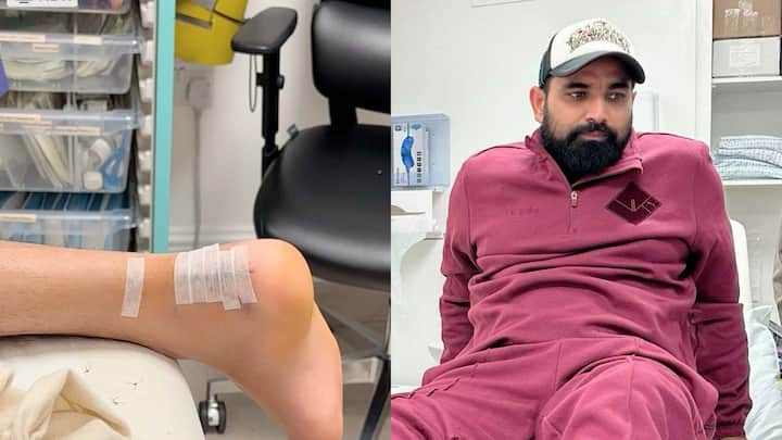 mohammed shami update on comeback injury stitches removed IPL 2024 IPL 2024: कट गए हैं शमी के पैर के टांके, जानें कमबैक को लेकर क्या दिया अपडेट