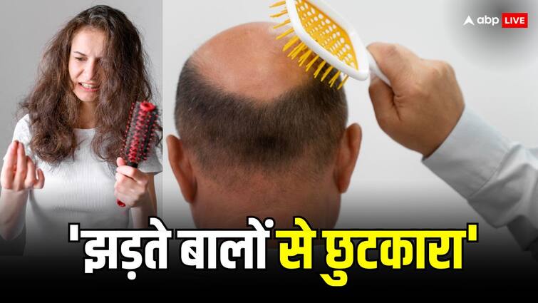 hairfall problem solution follow these remedies for remove dandruff naturally इन टिप्स को फॉलो करने से नहीं झड़ेंगे बाल... रूसी की दिक्कत से मिलेगा छुटकारा