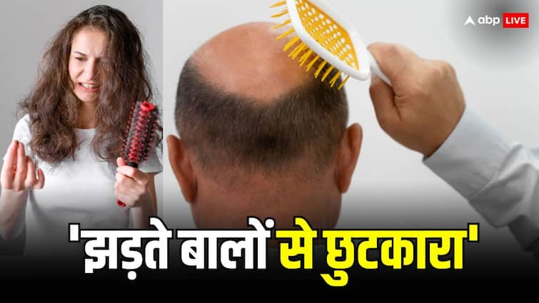 इन टिप्स को फॉलो करने से नहीं झड़ेंगे बाल…रूसी की दिक्कत से मिलेगा छुटकारा