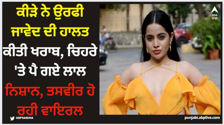 uorfi-javed-insect-bite-infection-spread-all-over-her-face-actress-share-update Uorfi Javed: ਕੀੜੇ ਨੇ ਉਰਫੀ ਜਾਵੇਦ ਦੀ ਹਾਲਤ ਕੀਤੀ ਖਰਾਬ, ਚਿਹਰੇ 'ਤੇ ਪੈ ਗਏ ਲਾਲ ਨਿਸ਼ਾਨ, ਤਸਵੀਰ ਹੋ ਰਹੀ ਵਾਇਰਲ