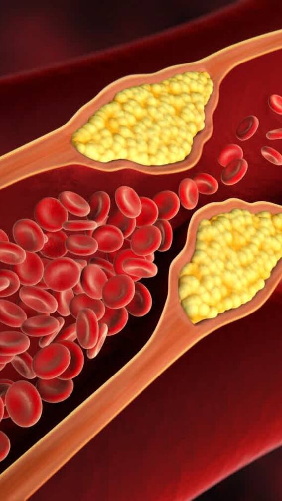 కొలెస్ట్రాల్​ను కంట్రోల్ చేసే మార్నింగ్ డ్రింక్స్ ఇవే