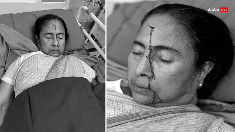 mamata banerjee sustained a major injury admitted in hospital  Mamata Banerjee Head Injury: पश्चिम बंगाल की मुख्यमंत्री ममता बनर्जी के सिर पर लगी चोट, अस्पताल में भर्ती