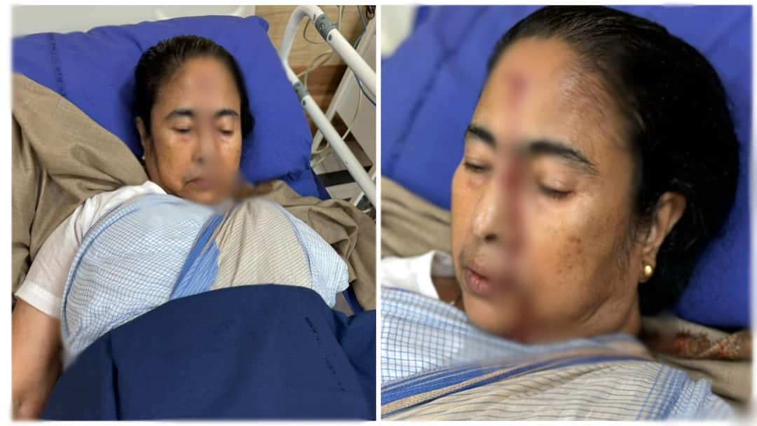 Mamata Banerjee: நெற்றியில் பலத்த காயத்துடன் மம்தா பானர்ஜி அனுமதி! என்ன நடந்தது? West bengal CM Mamata Banerjee Suffered Major Injury Trinamool Congress Mamata Banerjee: நெற்றியில் பலத்த காயத்துடன் மம்தா பானர்ஜி அனுமதி! என்ன நடந்தது?