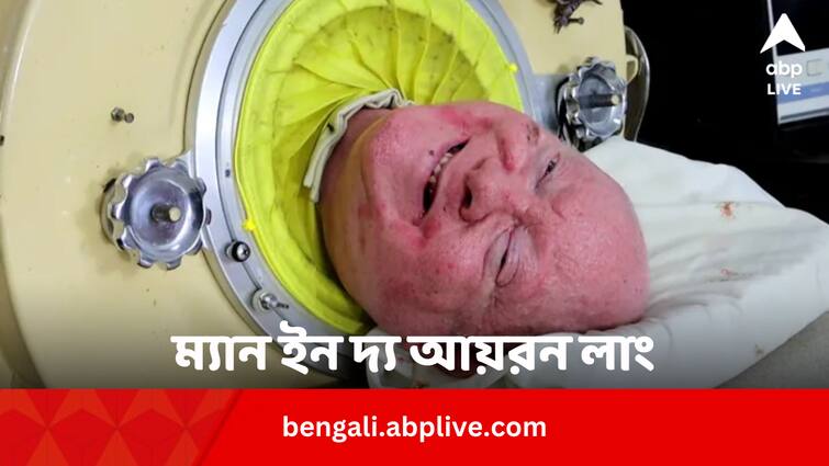 Paul Alexander Death Man in the Iron Lung Paul Alexander Dies at Age of 78 In Bengali Paul Alexander Death: সিলিন্ডারের মধ্যেই কেটেছে ৭০ বছর, প্রয়াত হলেন ম্যান ইন দ্য আয়রন লাং পল আলেক্সান্ডার