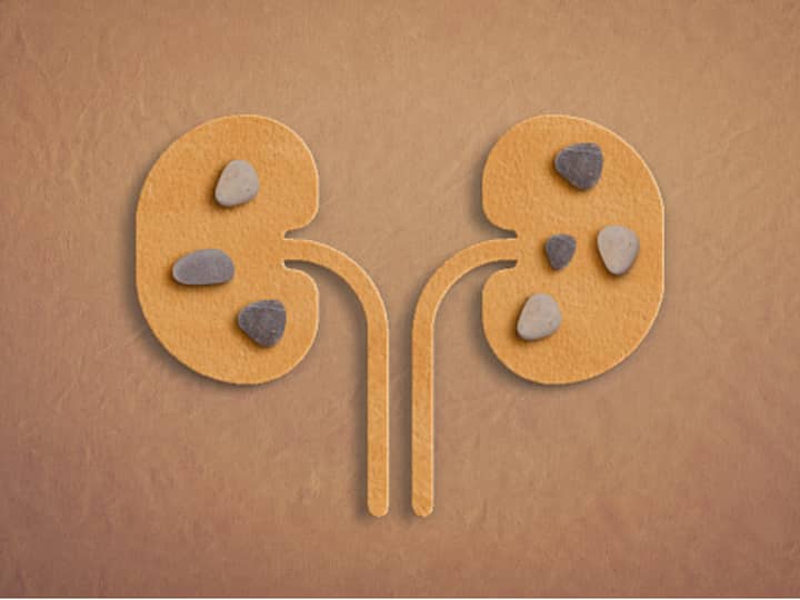 Averting Kidney Diseases: Various kidney-related diseases, such as stones, infections, or chronic kidney disease (CKD), can be prevented by taking proactive steps to maintain the health of your kidney.  If detected early, managing it is easier, aiding overall well-being. (Image source: Getty Images)