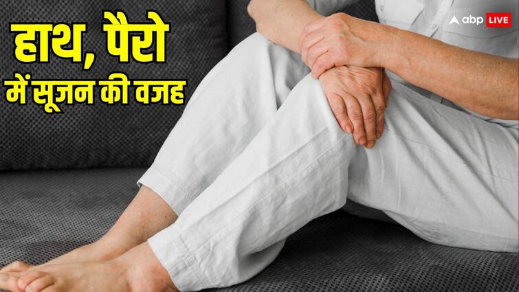 know why swelling occur in hands and feet learn prevention and causes ​हाथ, पैरों में क्यों आती है सूजन, जानें इसके बचाव और कारण