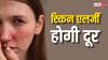 इन चीजों को डाइट में करें शामिल, स्किन एलर्जी रहेगी हमेशा दूर...कम दिनों में दिखेगा असर