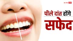 पीले दांतों की वजह से आती है शर्म, तो ये उपाय 15 दिन में कर देंगे दांत साफ
