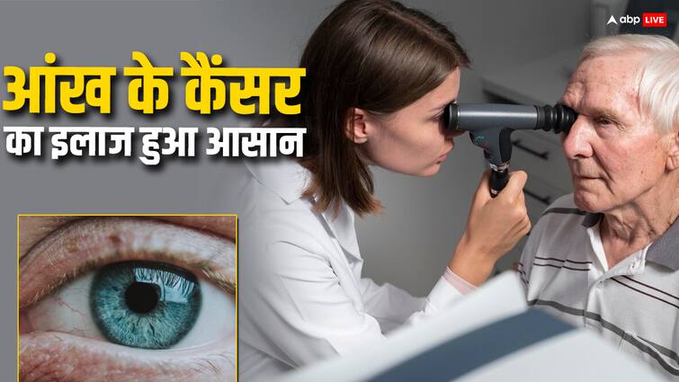 gamma knife radio therapy help eye cancer patient without any harm अब 30 मिनट में होगा आंखों के कैंसर का खात्मा, एम्स ने शुरू किया गामा नाइफ रेडियोथैरेपी से इलाज