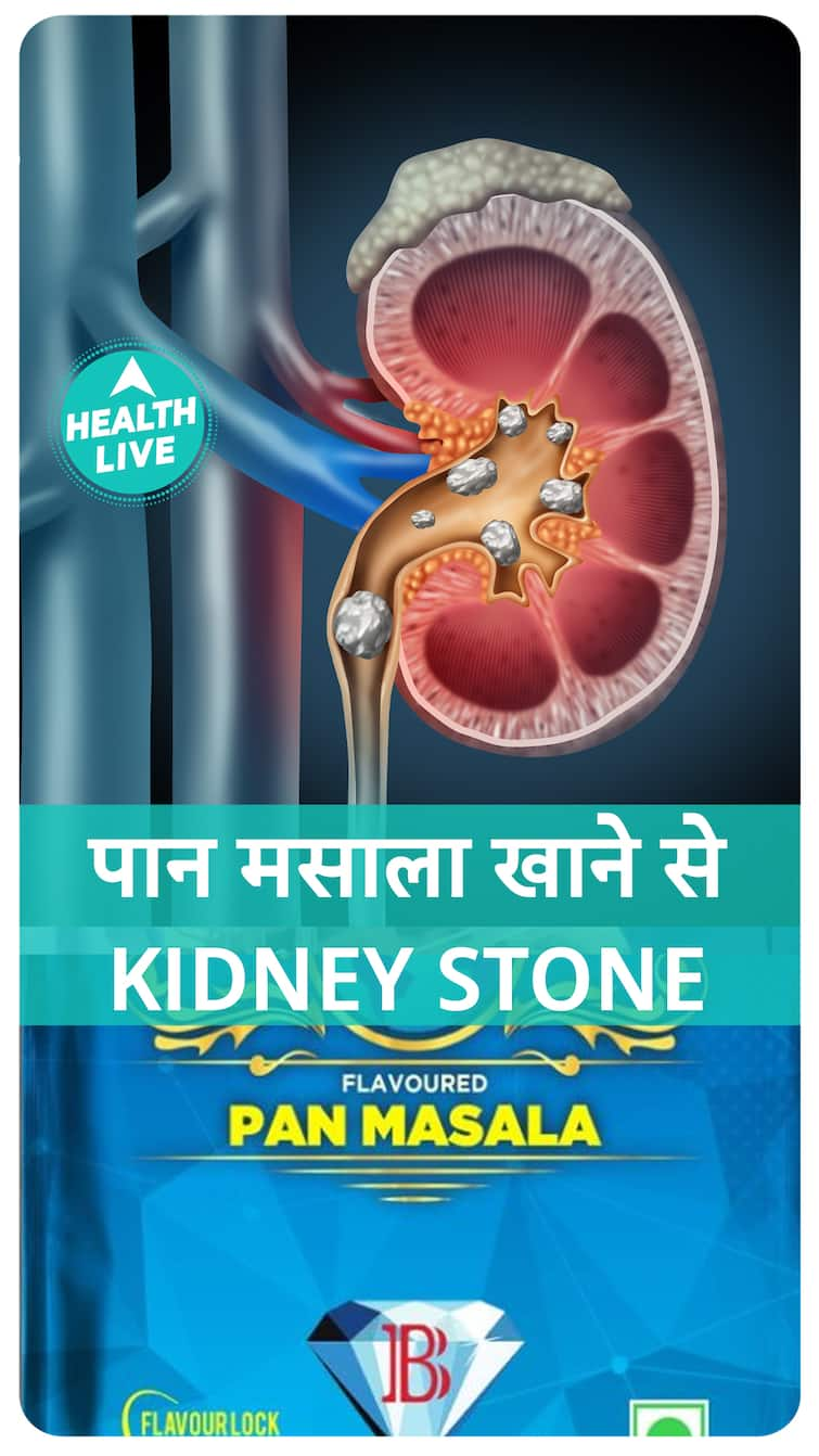 क्या पान मसाला खाने से हो सकता है Kidney Stone ? सुनिए क्या कहती है ये study..| Health Live