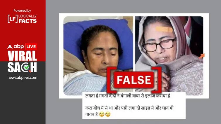 old photo of Bengal CM Mamata Banerjee being viral as she faked injury बंगाल की सीएम ममता बनर्जी की चोट को झूठा बताने के लिए शेयर हो रही पुरानी फोटो