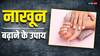 लड़कियों के नहीं बढ़ रहे नाखून, तो ना हो परेशान, करें ये आसान उपाय