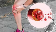 High Uric Acid: बढ़ा हुआ है यूरिक एसिड तो इन ट्रिक्स को करें फॉलो, तुरंत होगा कंट्रोल