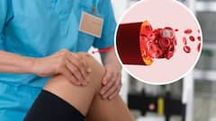 High Uric Acid: बढ़ा हुआ है यूरिक एसिड तो इन ट्रिक्स को करें फॉलो, तुरंत होगा कंट्रोल