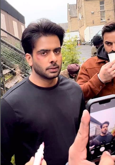 ਮਨਕੀਰਤ ਔਲਖ ਦੇ ਮੂੰਹ 'ਤੇ ਲੱਗੀਆਂ ਸੱਟਾਂ, ਤਸਵੀਰਾਂ ਵਾਇਰਲ