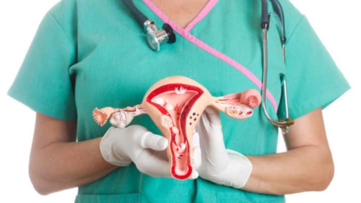 Ovarian Cancer Third Most Common Disease Women India Symptoms Diagnosis Treatments Ovarian Cancer Is The Third Most Common Disease In Women In India. Know Symptoms And Treatments
