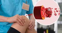 High Uric Acid: યુરિક એસિડમાં થયો છે વધારો તો આ ટ્રિક્સને કરો ફોલો, તરત થશે કંન્ટ્રોલ