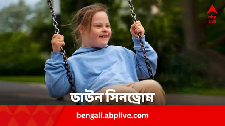 Down Syndrome What is Down Syndrome Causes Symptoms Diagnosis in Bengali Down Syndrome: ডাউন সিনড্রোম বোঝা সম্ভব গর্ভাবস্থাতেই, উপায় ?