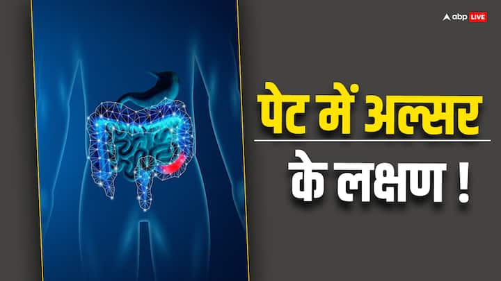 Stomach Ulcer: पेट में अल्सर भले ही एक आम समस्या है लेकिन अगर इसे नजरअंदाज किया जाएगा तो यह खतरनाक रूप ले सकती है. इसमें पेट के अंदरूनी परत पर घाव हो जाता है.