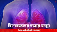 যক্ষ্মা রোগ শুধু কাশিতেই বোঝা যায়, তা নয় !