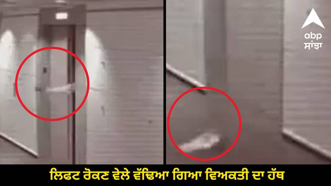 A person used his hand to stop the lift it got cut and fell ਮਾੜੇ ਦਿਲ ਵਾਲੇ ਨਾ ਹੀ ਦੇਖਿਓ ! ਲਿਫਟ ਰੋਕਣ ਵੇਲੇ ਵੱਢਿਆ ਗਿਆ ਵਿਅਕਤੀ ਦਾ ਹੱਥ, ਦੇਖੋ ਵੀਡੀਓ