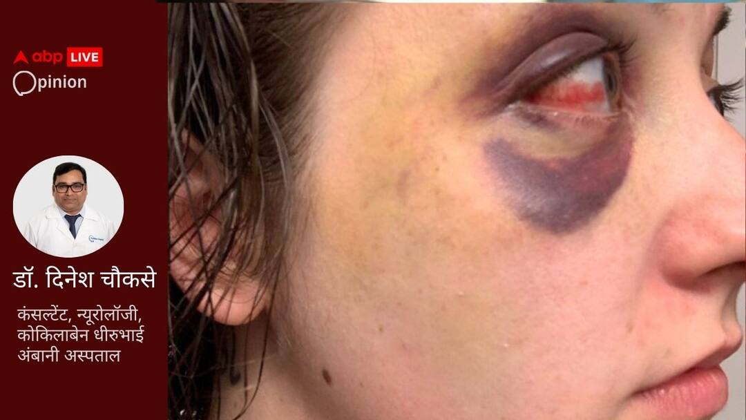 How the problem of epilepsy in children can be different from that of adults मिर्गी जागरूकता दिवस: दुनियाभर के 5 करोड़ लोग मिर्गी की चपेट में, वयस्कों से अलग बच्चों में ये समस्या