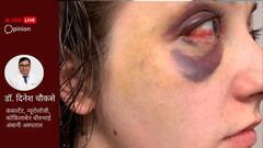 मिर्गी जागरूकता दिवस: दुनियाभर के 5 करोड़ लोग मिर्गी की चपेट में, वयस्कों से अलग बच्चों में ये समस्या