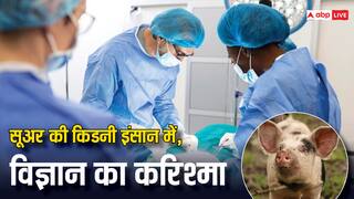OMG ! इंसान में लगाई गई सूअर की किडनी, दुनिया में पहली बार हुआ ऐसा करिश्मा