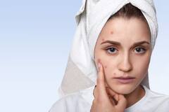 Skin Care: रात को सोने से पहले कर लें ये  छोटा सा काम...चेहरे के सारे पिंपल हो जाएंगे साफ
