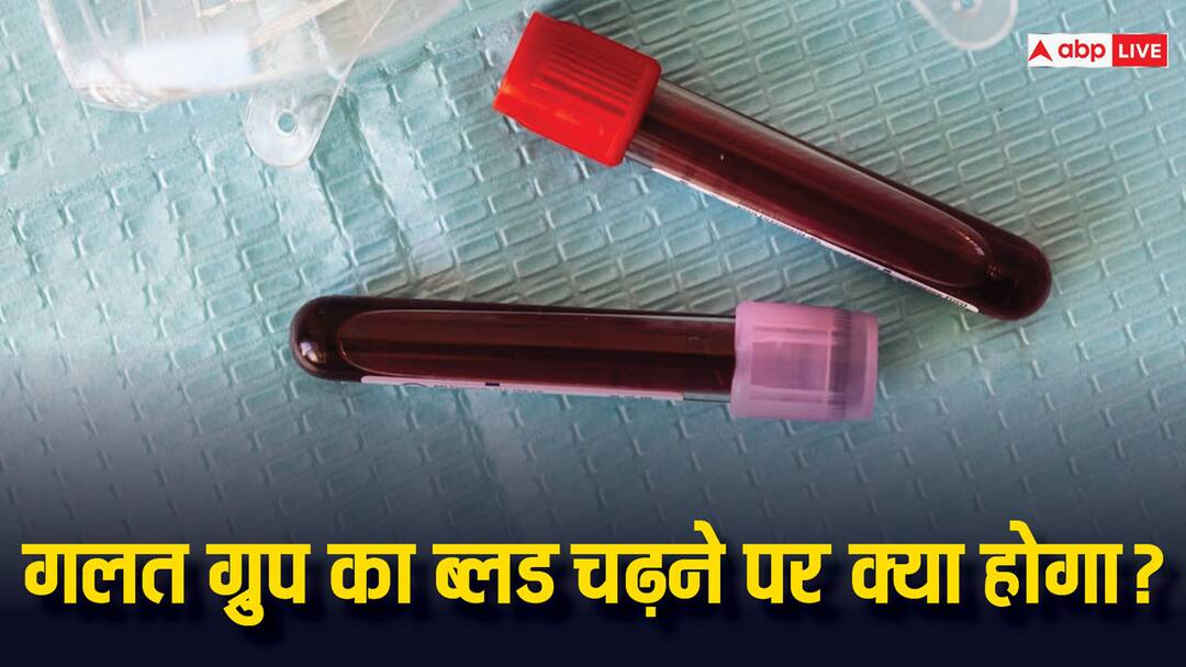 अगर किसी को गलत ग्रुप का ब्लड चढ़ा दिया जाए तो क्या होगा, कितने होंगे ऐसे मरीज के बचने के चांस? body happen if blood of wrong group is given to someone body chances of survival of such a patient अगर किसी को गलत ग्रुप का ब्लड चढ़ा दिया जाए तो क्या होगा, कितने होंगे ऐसे मरीज के बचने के चांस?