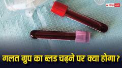 अगर किसी को गलत ग्रुप का ब्लड चढ़ा दिया जाए तो क्या होगा, कितने होंगे ऐसे मरीज के बचने के चांस?